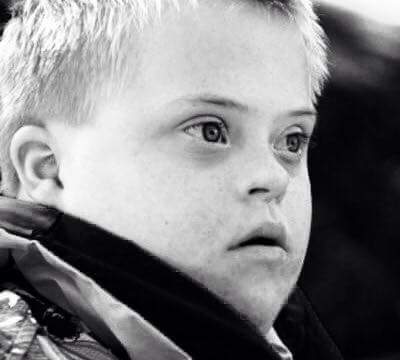 DJECA S POTEŠKOĆAMA U RAZVOJU I BULLYING