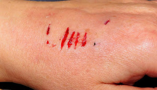 TREND SAMOPOVREĐIVANJA KOD TINEJDŽERA U OSNOVNOJ ŠKOLI ŠIRI SE DRUŠTVENOM MREŽOM – INSTAGRAMOM